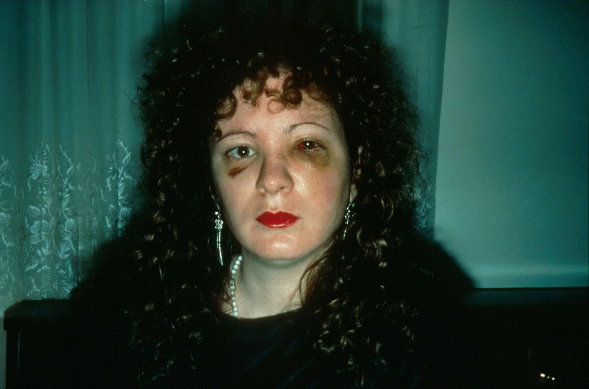 Nan goldin custom 4 - Quand la photographie est-elle rentrée dans l'intime ? - Thomas Hammoudi - Histoire