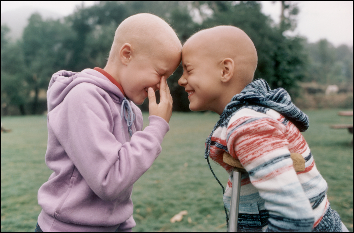 Mary Ellen Mark, Jennifer Turk (left) and Samantha Brais at Camp Goodtimes,a summer camp for children with cancer, Malibu, California, 1984
