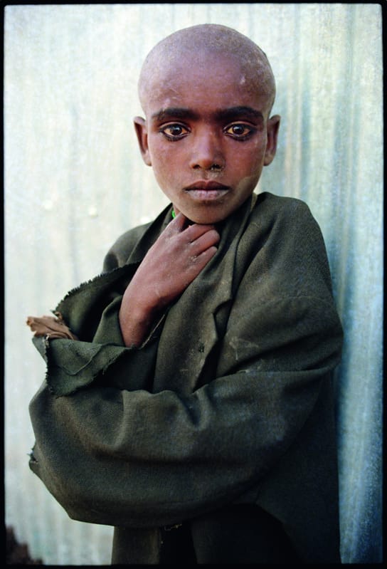 Mary Ellen Mark, Relief camp, Korem, Ethiopia, 1985