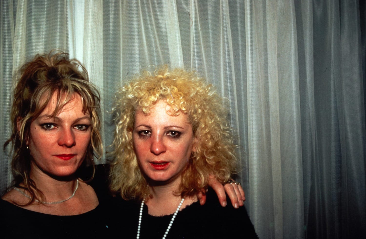 Nan Goldin, Cookie with me after I was punched, Baltimore, 1986
