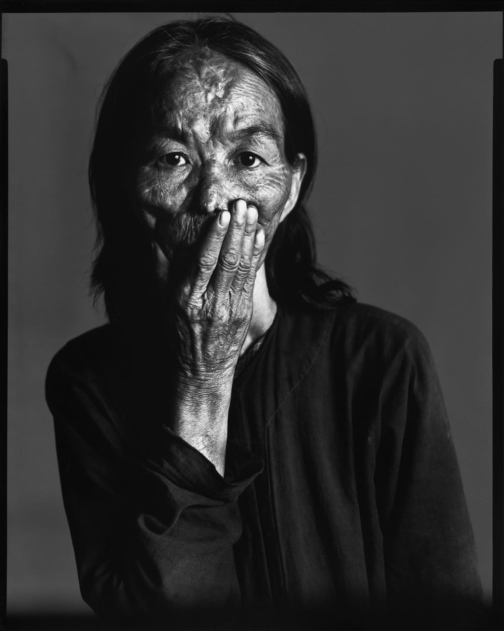 Portrait sur fond blanc d'une victime civile de napalm au Vietnam, par Richard Avedon