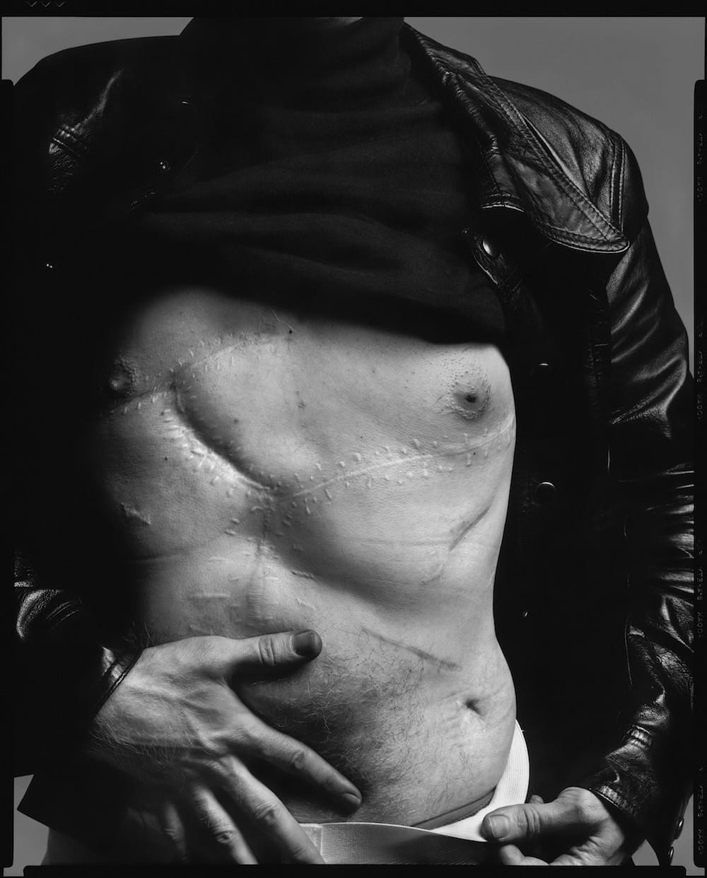 Andy Warhol ouvrant son blouson sur les cicatrices des balles de Valerie Solanas, par Richard Avedon