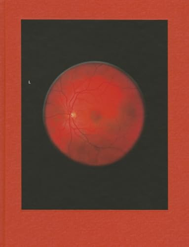 Couverture de Retinal Shift